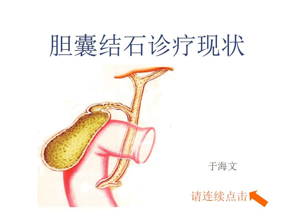 PPT111 Surgery of each department - gallbladder stones and its prevention